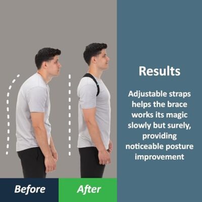 Comfybrace Posture Corrector-Back Brace For Men And Women- Fully Adjustable Straightener For Mid, Upper Spine Support- Neck, Shoulder, Clavicle And Back Pain Relief-Breathable - Image 2